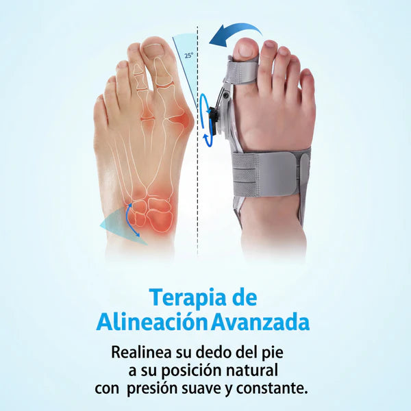OrthoFlex™: Sistema Corrector para Juanetes